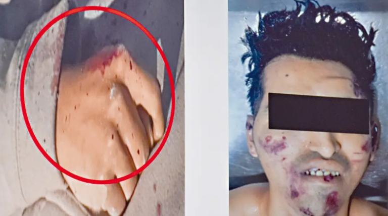 Investigan muerte de hombre en la Petrolera: sospechan que fue golpeado con piedra